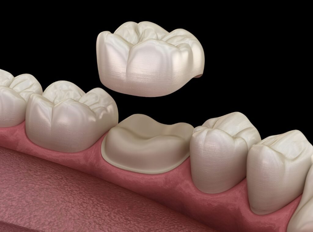 Professional dentist preparing a custom dental crown for a patient during a restorative dental treatment in a modern dental clinic.